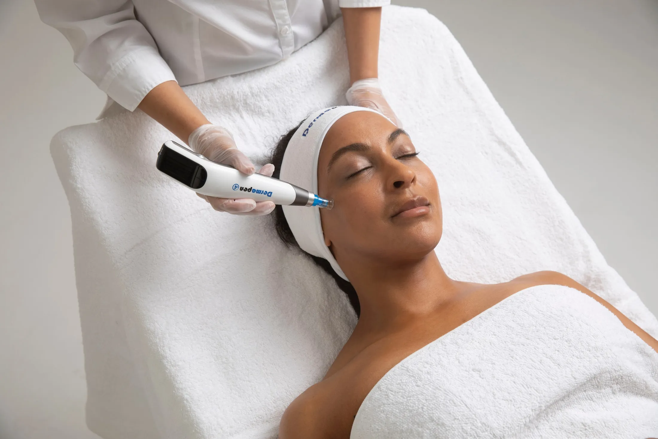A Dermapen 4 microneedling treatment on the cheek